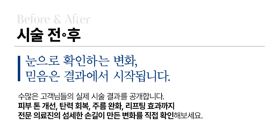 전후사진